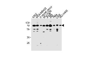 Western blot analysis in K562,MDA-MB453,NCI-H292,A549,293,Hela,CEM,NCI-H460 cell line and human nomal uterus tissue lysates (35ug/lane). (PARP3 anticorps  (N-Term))