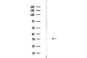 anti-Kallikrein 5 (KLK5) antibody