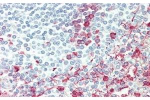 Detection of ITGb6 in Human Spleen Tissue using Polyclonal Antibody to Integrin Beta 6 (ITGb6)