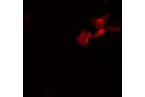 ABIN6274100 staining  HeLa cells by IF/ICC. (PHF1 anticorps  (Internal Region))