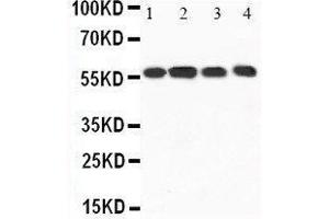 Anti-CaMKK antibody, Western blotting Lane 1: Rat Brain Tissue Lysate Lane 2: Rat Brain Tissue Lysate Lane 3: Mouse Brain Tissue Lysate Lane 4: Mouse Brain Tissue Lysate