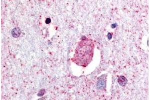 Immunohistochemical (Formalin/PFA-fixed paraffin-embedded sections) staining in human brain, neurons and glia with GPR88 polyclonal antibody . (GPR88 anticorps  (C-Term))