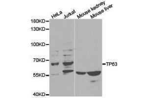 Western Blotting (WB) image for anti-Tumor Protein P63 (TP63) antibody (ABIN1875171)