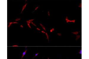 Immunofluorescence analysis of PC-12 cells using CD40L Polyclonal Antibody at dilution of 1:100. (CD40 Ligand anticorps)