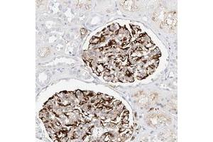Immunohistochemical staining of human kidney with CDCP2 polyclonal antibody  shows distinct membrane positivity in renal glomeruli.