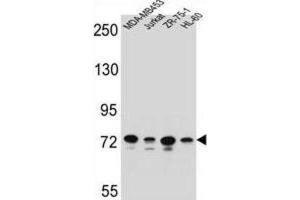Western Blotting (WB) image for anti-Protocadherin beta 15 (PCDHB15) antibody (ABIN2996491) (PCDHB15 anticorps)