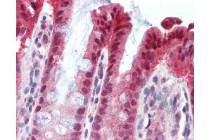 Anti-NR1I3 antibody IHC of human colon.