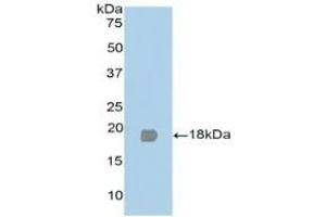 Detection of Recombinant PPARg, Human using Polyclonal Antibody to Peroxisome Proliferator Activated Receptor Gamma (PPARg) (PPARG anticorps  (AA 349-488))
