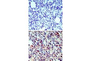 Immunohistochemical analysis of Cd207 in paraffin-embedded formalin-fixed mouse breast tissue using an isotype control (top) and Cd207 polyclonal antibody  (bottom) at 5 ug/mL . (CD207 anticorps  (AA 36-44))