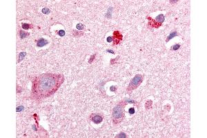 Anti-ROR Beta antibody IHC of human brain, cortex. (RORB anticorps  (Hinge Region))