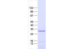 Validation with Western Blot