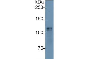 Western Blot; Sample: Mouse Heart lysate; Primary Ab: 1µg/ml Rabbit Anti-Mouse HK1 Antibody Second Ab: 0.