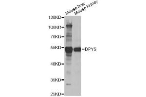 Western blot analysis of extracts of various cell lines, using DPYS antibody (ABIN2562285) at 1:1000 dilution. (DPYS anticorps)