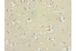 Immunohistochemistry of paraffin-embedded human brain tissue using ABIN7167729 at dilution of 1:100 (RFPL2 anticorps  (AA 99-378))
