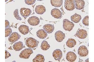 IHC analysis of DAZAP1 using anti-DAZAP1 antibody (ABIN6719309). (DAZAP1 anticorps  (AA 1-189))