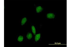 Immunofluorescence of purified MaxPab antibody to ARHGAP9 on HeLa cell. (ARHGAP9 anticorps  (AA 1-750))