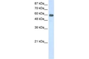 Western Blotting (WB) image for anti-TROVE Domain Family, Member 2 (TROVE2) antibody (ABIN2462169) (TROVE2 anticorps)