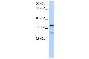 WB Suggested Anti-KCNIP2  Antibody Titration: 0. (KCNIP2 anticorps  (N-Term))