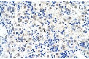 Immunohistochemical staining (Formalin-fixed paraffin-embedded sections) of human liver with DDX47 polyclonal antibody  at 4-8 ug/mL working concentration. (DDX47 anticorps  (C-Term))