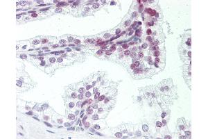 Human Prostate: Formalin-Fixed, Paraffin-Embedded (FFPE). (ZMYM6 anticorps  (AA 17-66))