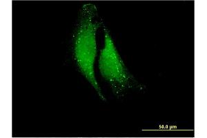 Immunofluorescence of monoclonal antibody to ELA1 on HeLa cell.