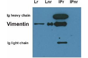 Immunoprecipitation of vimentin from HeLa cell lysate by antibody VI-10 and its detection by antibody VI-01.