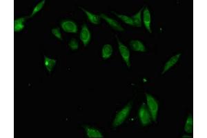 Immunofluorescent analysis of Hela cells using ABIN7176303 at dilution of 1:100 and Alexa Fluor 488-congugated AffiniPure Goat Anti-Rabbit IgG(H+L)