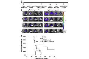 Anti-PD-1 antibody plus radiation therapy (RT) cures mice with intracranial GL261-luc tumors.