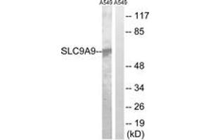 Western Blotting (WB) image for anti-Solute Carrier Family 9, Subfamily A (NHE9, Cation Proton Antiporter 9), Member 9 (SLC9A9) (AA 171-220) antibody (ABIN2890645) (SLC9A9 anticorps  (AA 171-220))