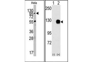 Image no. 1 for anti-TYRO3 Protein Tyrosine Kinase (TYRO3) antibody (ABIN359941) (TYRO3 anticorps)