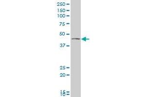 VAT1 polyclonal antibody (A01), Lot # 060608JCS1 Western Blot analysis of VAT1 expression in Jurkat . (VAT1 anticorps  (AA 294-392))