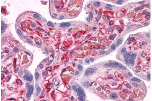 Human Placenta: Formalin-Fixed, Paraffin-Embedded (FFPE)