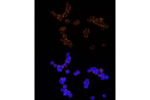 Immunofluorescence analysis of K-562 cells using NUDT19 Rabbit mAb (ABIN7269070) at dilution of 1:25 (40x lens).