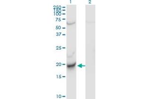 Western Blot analysis of CENPM expression in transfected 293T cell line by C22orf18 monoclonal antibody (M01), clone 4C12-2C8. (CENPM anticorps  (AA 1-180))