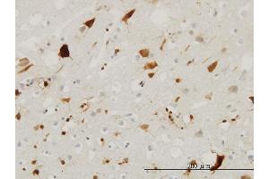 Immunoperoxidase of monoclonal antibody to PTN on formalin-fixed paraffin-embedded human cerebral cortex. (Pleiotrophin anticorps  (AA 45-154))