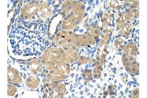Troponin I Type 1 antibody was used for immunohistochemistry at a concentration of 4-8 ug/ml to stain Epithelial cells of renal tubule (arrows) in Human Kidney. (TNNI1 anticorps)
