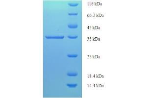SDS-PAGE (SDS) image for Tumor Protein D52 (TPD52) (AA 1-184) protein (His-SUMO Tag) (ABIN5710534)