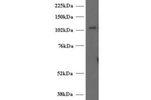 Western Blotting (WB) image for anti-Unc-13 Homolog D (UNC13D) (Internal Region) antibody (ABIN2466419) (UNC13D anticorps  (Internal Region))