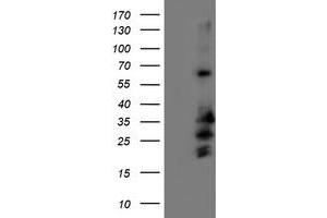 Western Blotting (WB) image for anti-Receptor Accessory Protein 2 (REEP2) antibody (ABIN1500658)