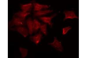 ABIN6278622 staining K562 by IF/ICC.