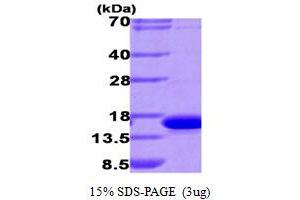 SDS-PAGE (SDS) image for Lectin, Galactoside-Binding, Soluble, 9 (LGALS9) (AA 1-148) (Active) protein (His tag) (ABIN667765)