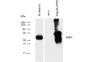 Western blotting analysis of PRR7 using mouse monoclonal antibody TRAP3/10 on rat neuron lysate, and on HeLa transfectants overexpressing human PRR7, compared with non-transfected HeLa cells (negative control).