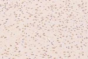 Immunohistochemistry analysis of paraffin-embedded rat substantia nigra using ZNF154 (ABIN7076261) at dilution of 1: 4000