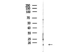 Western blot analysis of lysates from Hela cells(LPS,4h treatment), using Di-Methyl-Histone H3 (Lys14)/H3K14me2 Antibody at 1/1000 dilution.