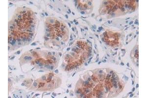 Detection of TFR2 in Human Stomach Tissue using Polyclonal Antibody to Transferrin Receptor 2 (TFR2)