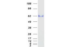 Validation with Western Blot