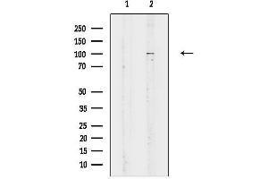 anti-Protein Kinase N3 (PKN3) (Internal Region) antibody