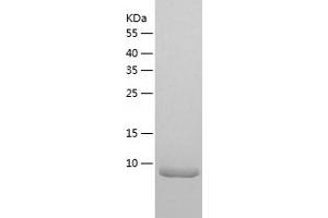 Western Blotting (WB) image for Connective Tissue Growth Factor (CTGF) (AA 253-349) protein (His tag) (ABIN7122477)