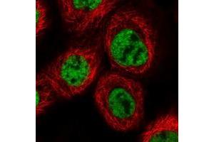 Immunofluorescent staining of human cell line A-431 with PRCC polyclonal antibody  at 1-4 ug/mL dilution shows positivity in nucleus but not nucleoli.