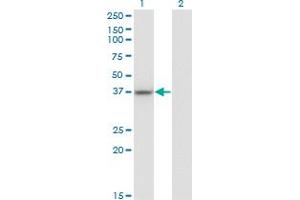 Western Blot analysis of LUC7L expression in transfected 293T cell line by LUC7L monoclonal antibody (M05), clone 2D10. (LUC7L anticorps  (AA 1-111))